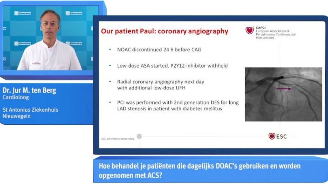 Behandeling van patinten die orale antistolling gebruiken en presenteren met ACS