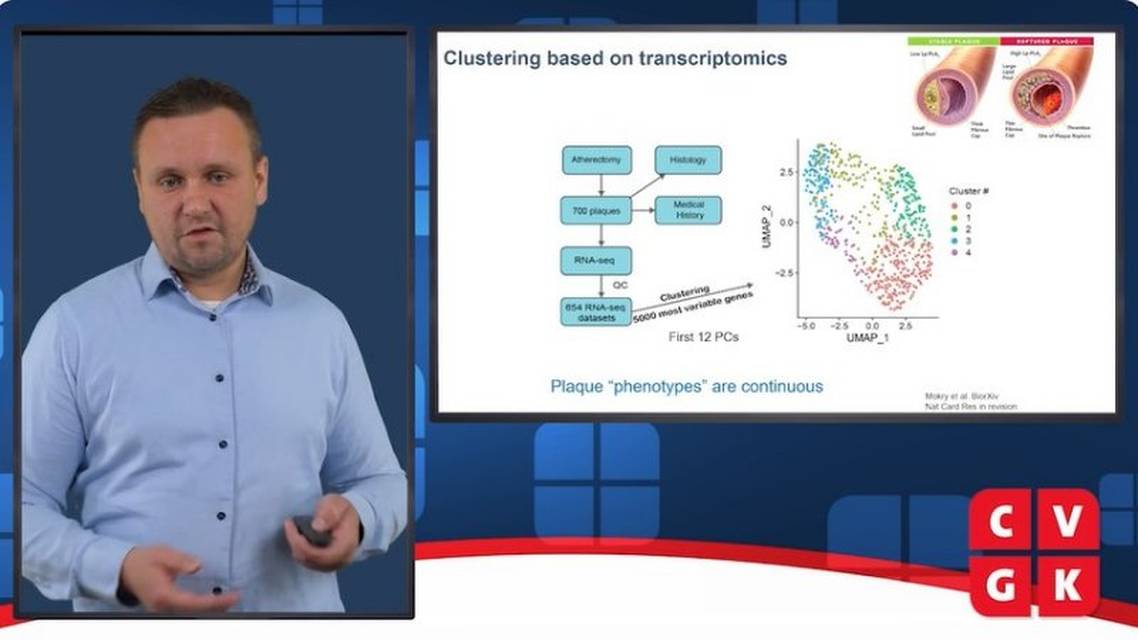 Innovatie op het gebied van atherosclerosebehandeling stratificeren van plaques