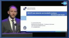 MRDTI voor detectie van recidief trombose