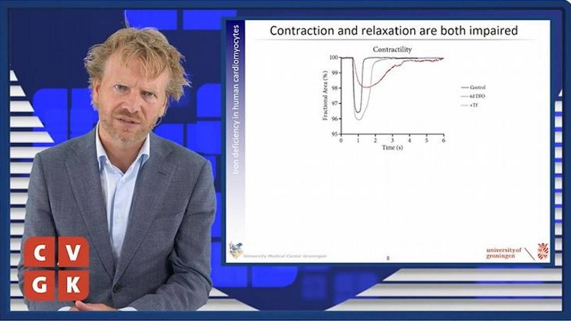 Directe effecten van ijzertekort op humane cardiomyocyten