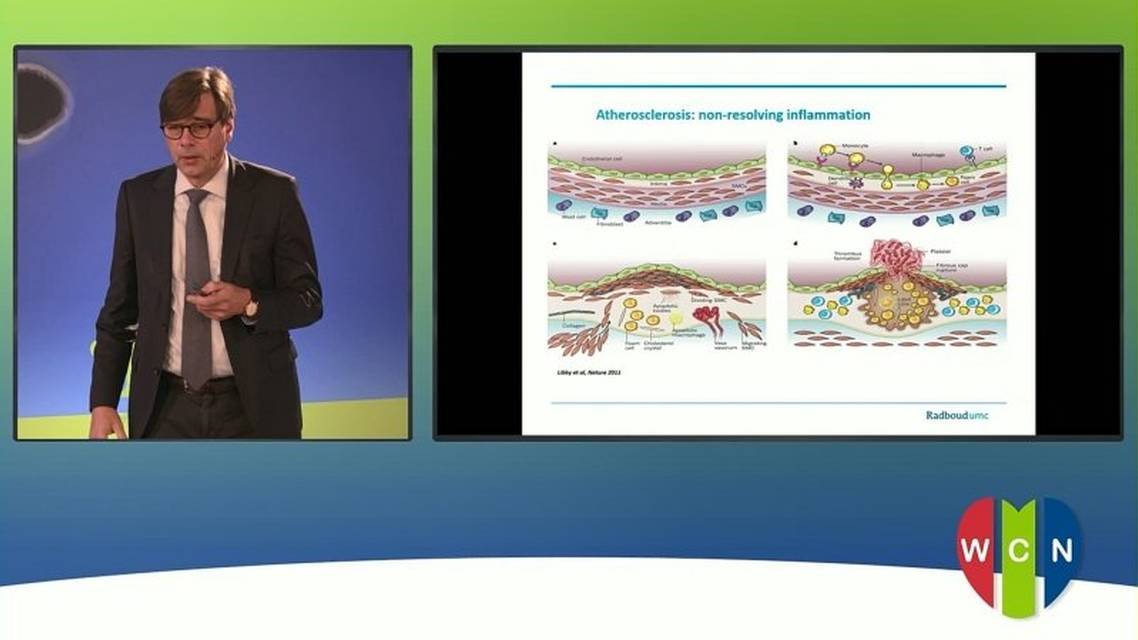 WCN network targets inflammation in CVD The LODOCO trial