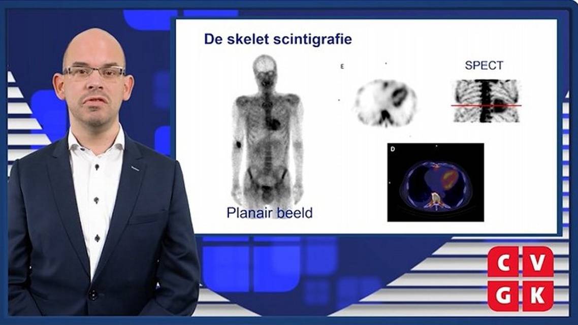 Bijdrage nucleaire geneeskunde voor diagnose van cardiale amylodose