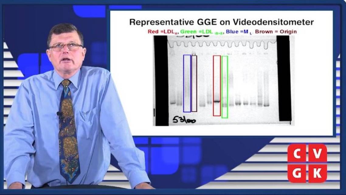 Laboratoriumonderzoek van lipiden en lipoprotenen