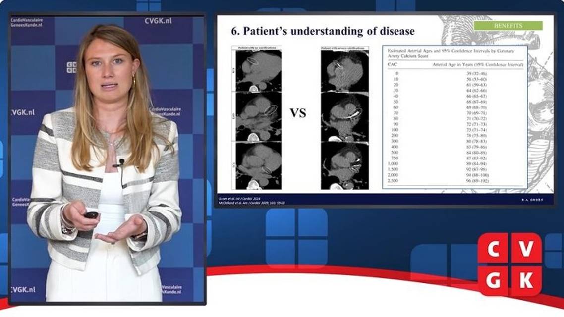 Voordelen van calciumscanning bij cardiovasculaire risicostratificatie
